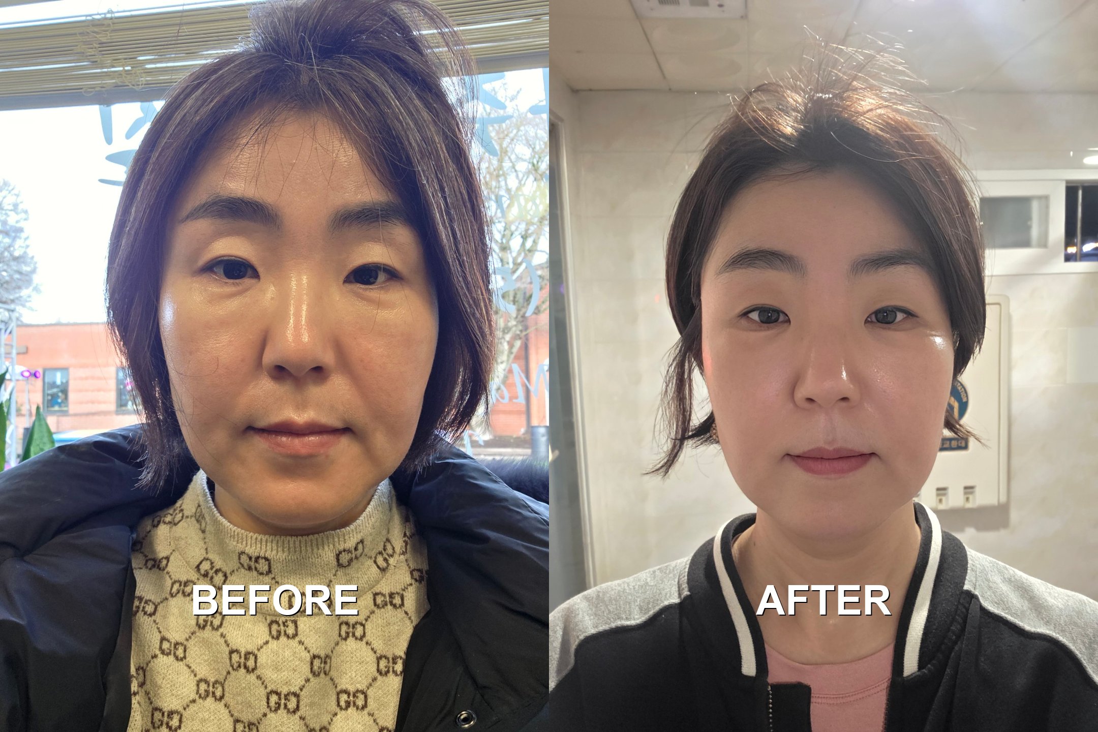 Before and after transformation